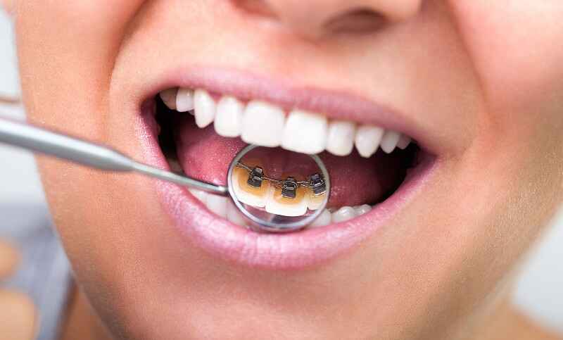 What is orthodontics?