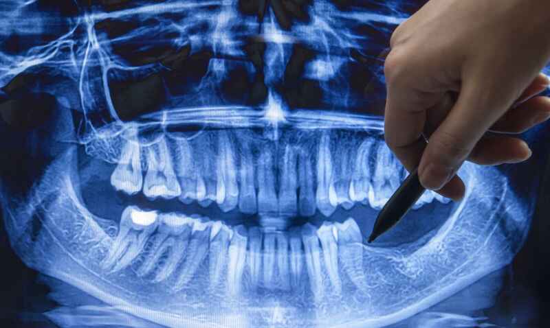 Scientists have learned how to grow teeth