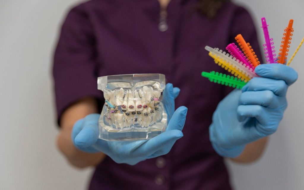 Prosthetics (Orthopedic Dentistry)