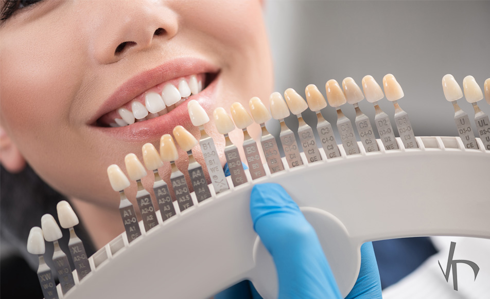 Ceramic crowns